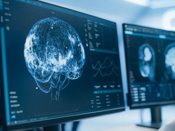 A scientist views a brain scan on a screen