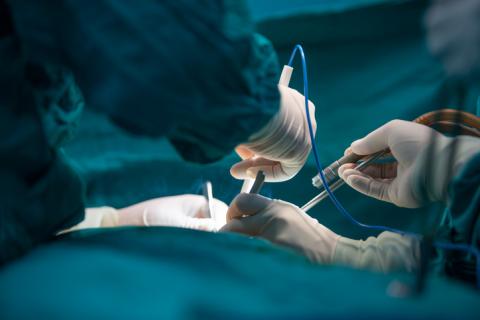 A surgery takes place in an operating theatre