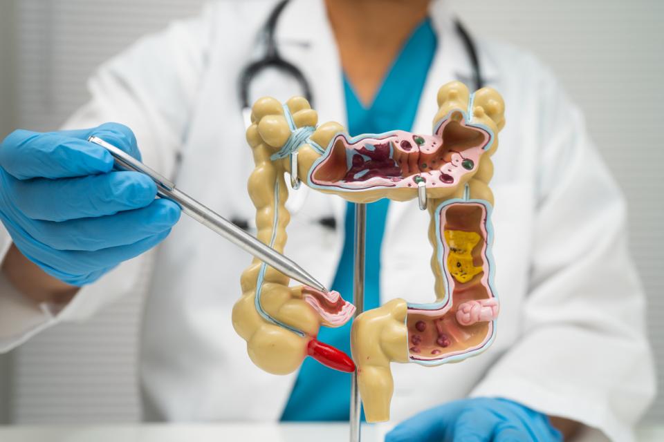 iStock/sasirin pamai